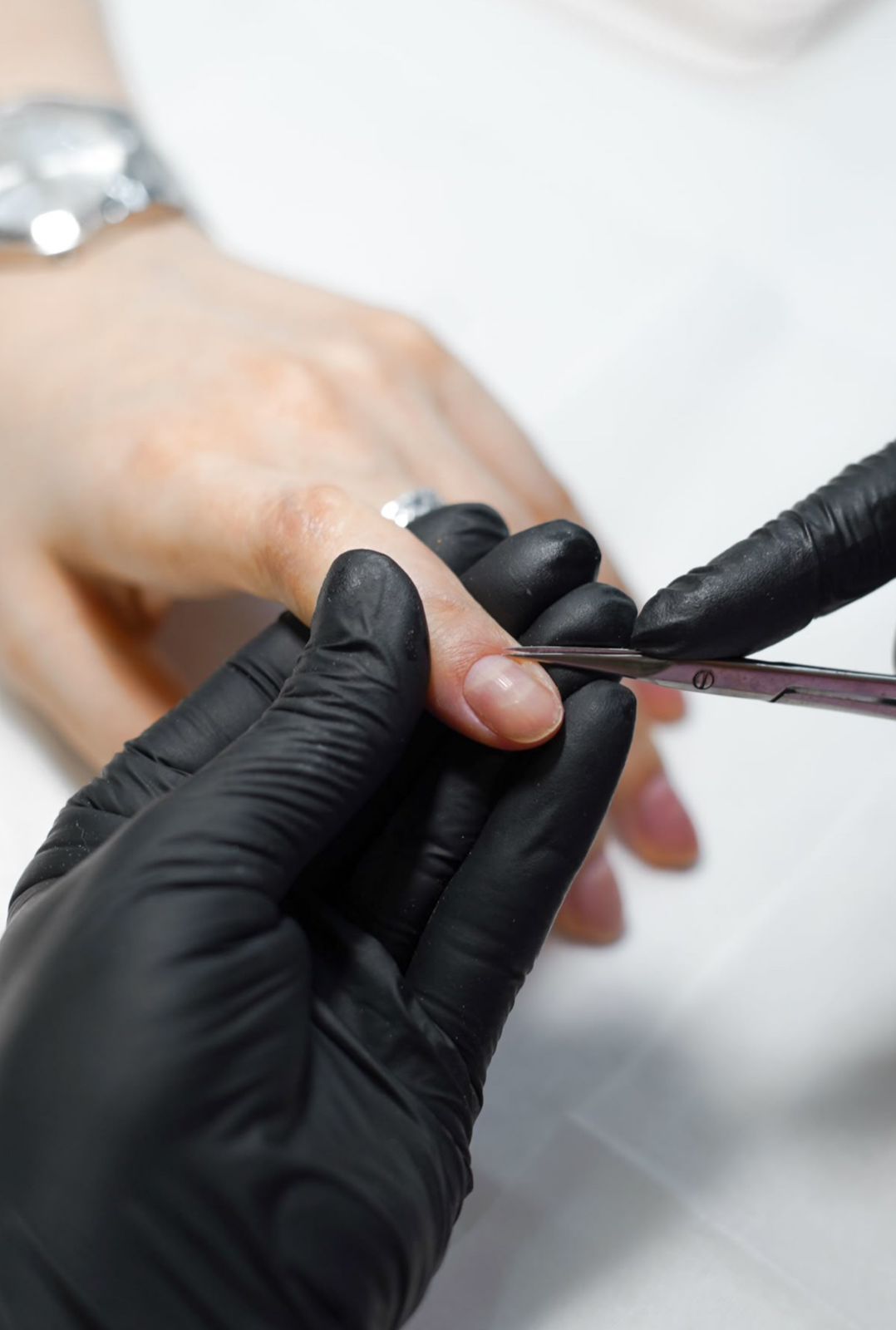 Nail Removal
